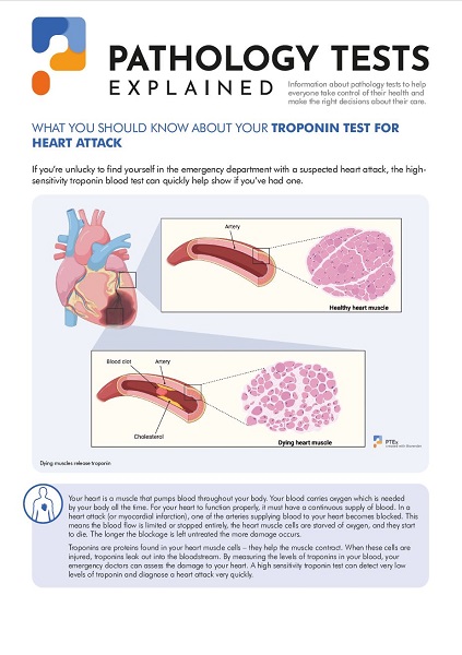 Troponin