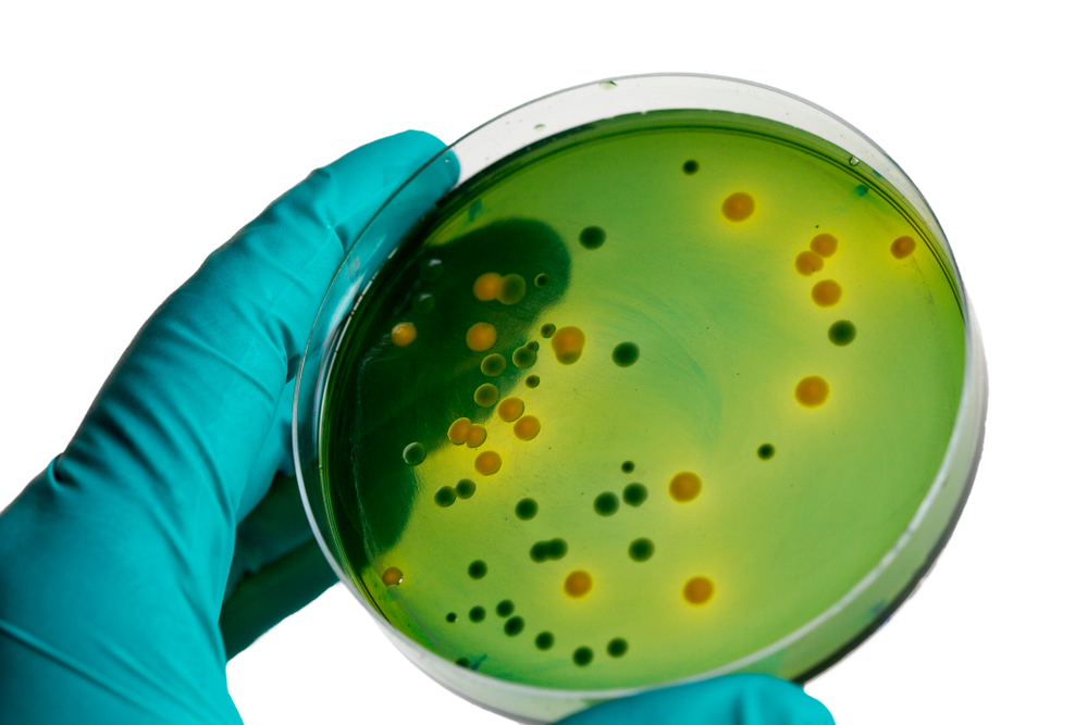 Staphylococcus aureus: Disease, Properties, Lab Diagnosis • Microbe Online